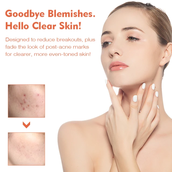 Acne removal glowing Toner - Image 3